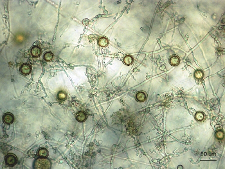 oospores.jpg